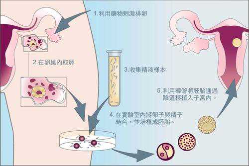 找试管代妈首选aa69_上海做**助孕周期要多久？前提需不需要做什么调理？